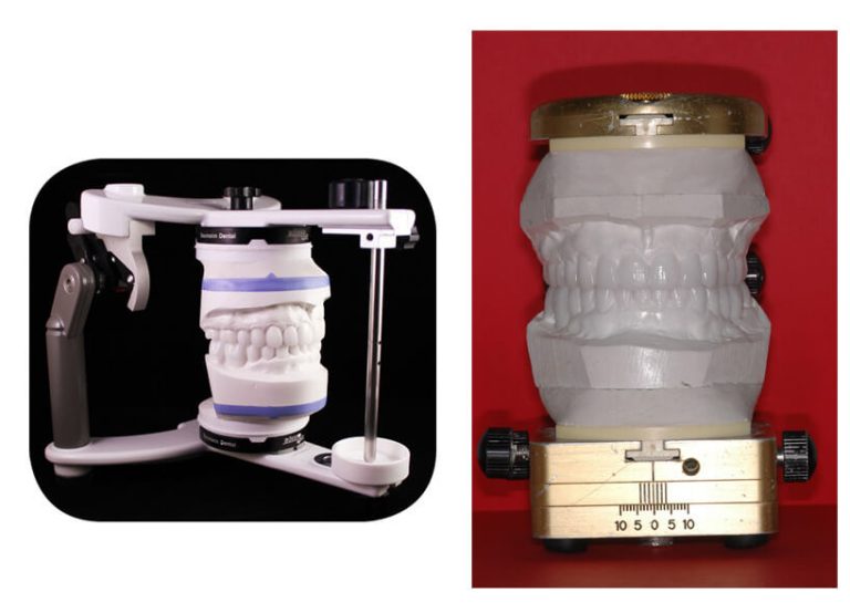Treatment Planning ProArt Dental Laboratory Where Art & Science Meet
