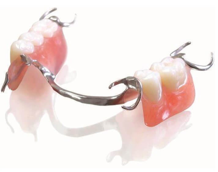 pro art partial dentures
