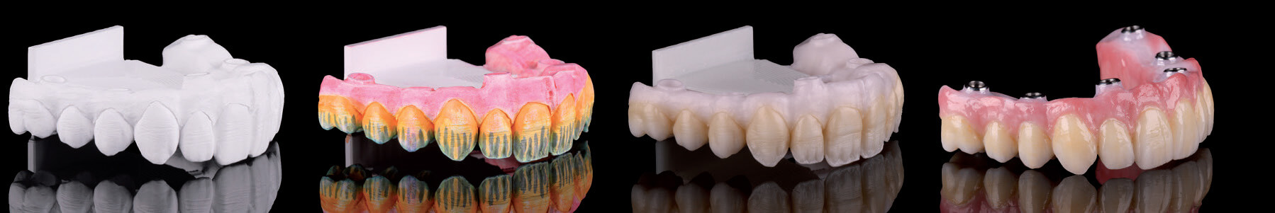 pro art prettau® zirconia enables full zirconia restorations with high biocompatibility for large bridges and implants