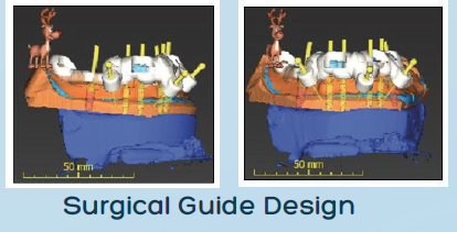 digital dental case planning proart lab