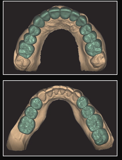 digital diagnostic treatment planning