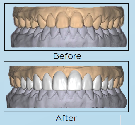 digital smile design service pro lab