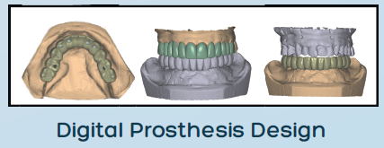 maxilla restoration porcelain crowns proart